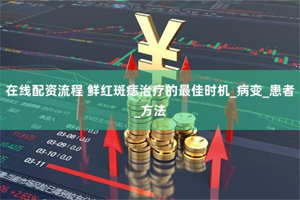 在线配资流程 鲜红斑痣治疗的最佳时机_病变_患者_方法